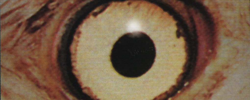 Painful lessons are billable lessons